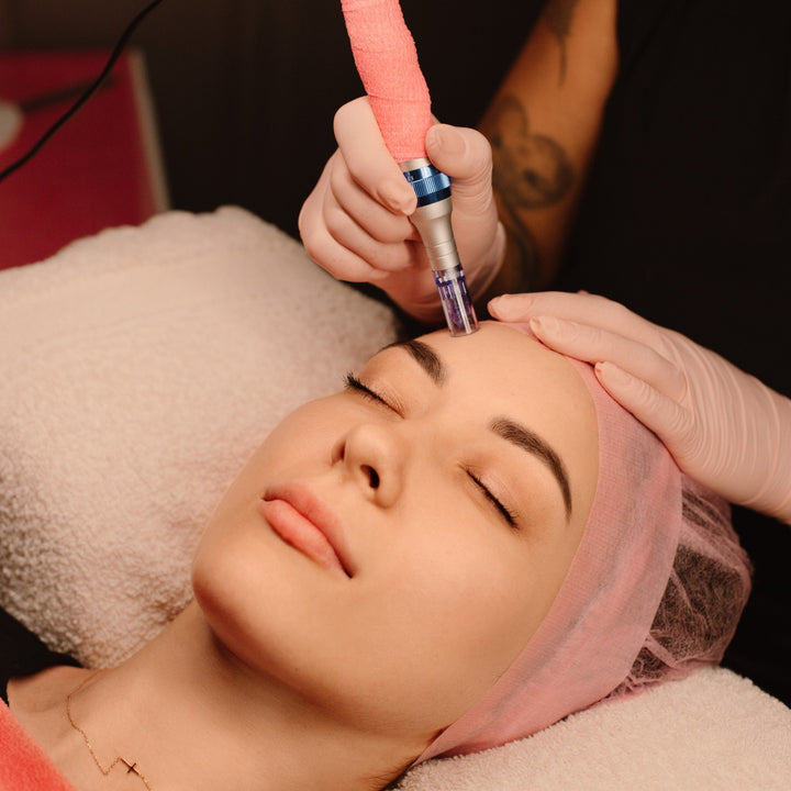 Microneedling - Book Online - Flamingo Beauty Spa